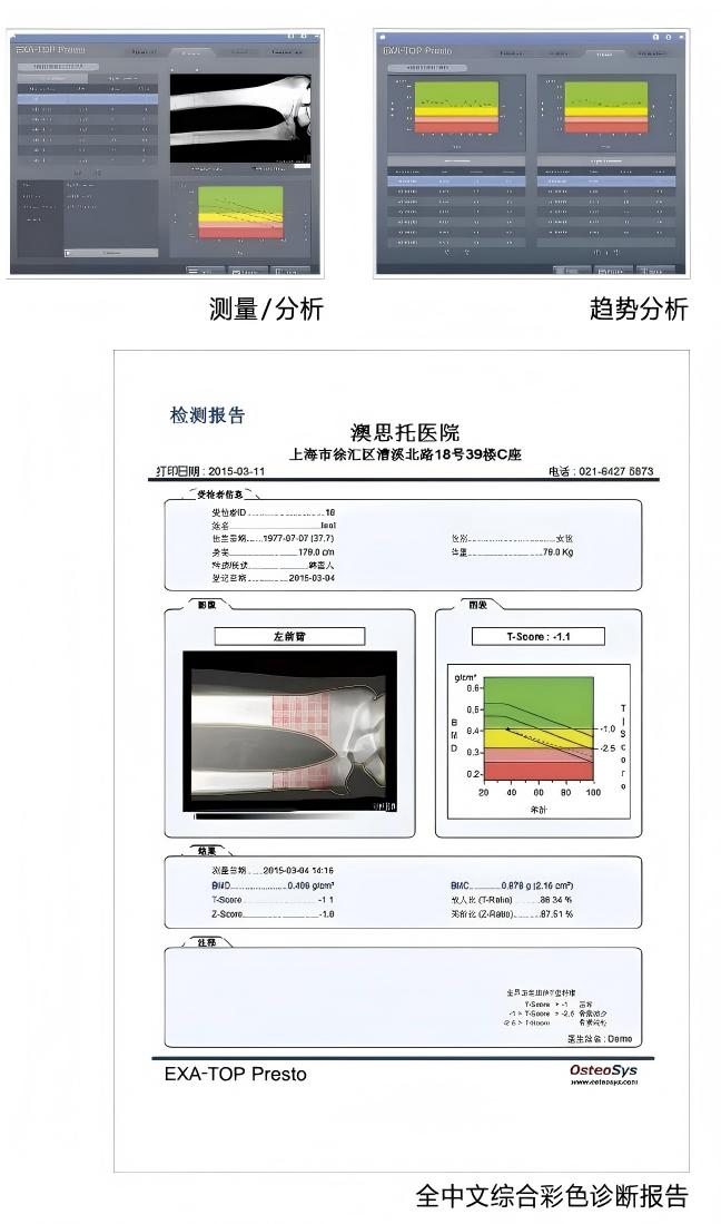 EXA-TOP Presto彩頁(yè)2023-國(guó)產(chǎn)_02(1).jpg
